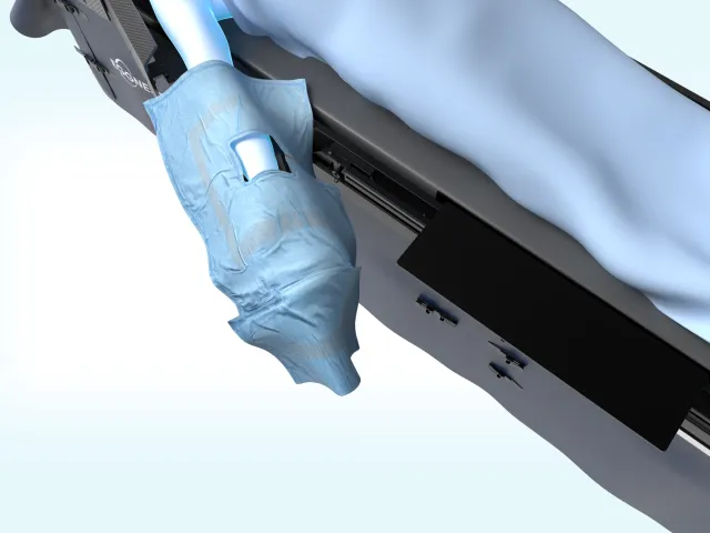 Close-up render of the ScatterPro drape around the patient's arm, its opening over the access site